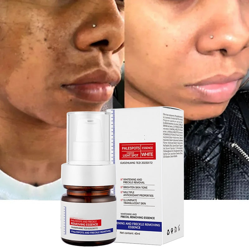 Vitamin C Whitening Freckles ESSENCE：Dark spots disappear, blemishes fade, and skin becomes radiant!